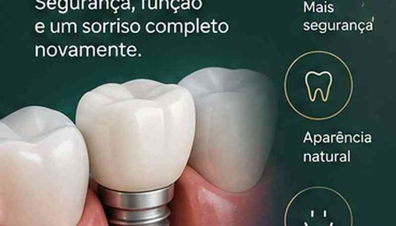Implante dentário representando tratamentos usados na estratégia de captação de pacientes odontológicos